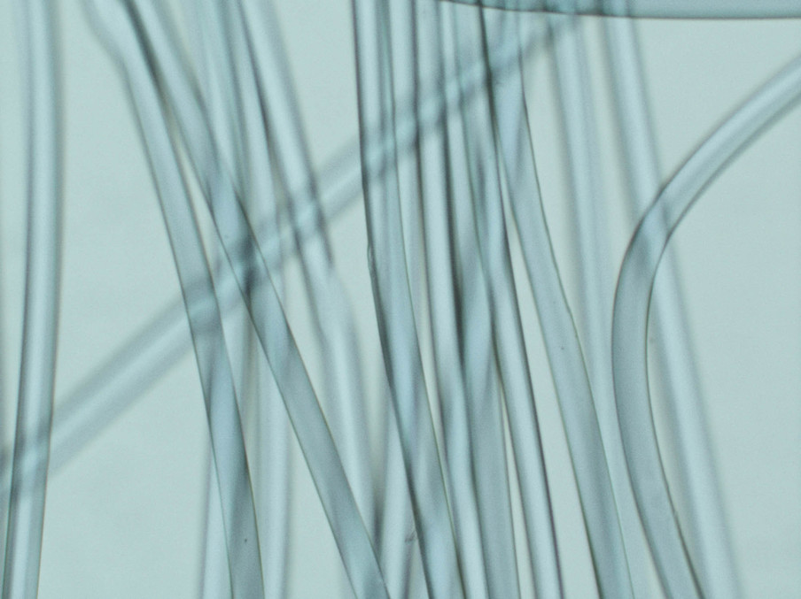 Microscopische foto van synthetische microvezels in verschillende kledingstukken, gemaakt in een laboratorium. Foto: Lisa van Casand (voor De Correspondent)