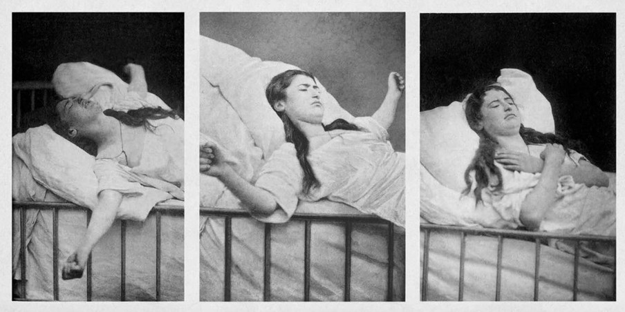 Foto’s: Albert Londe, in opdracht van Jean-Martin Charcot voor de Iconographie de la Salpêtrière (1878) 